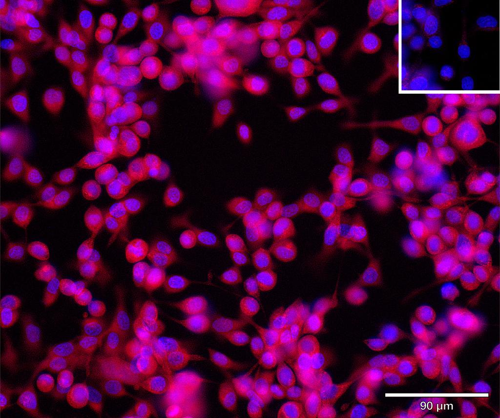 Ankyron FGF8_HUMAN Clone BL30107