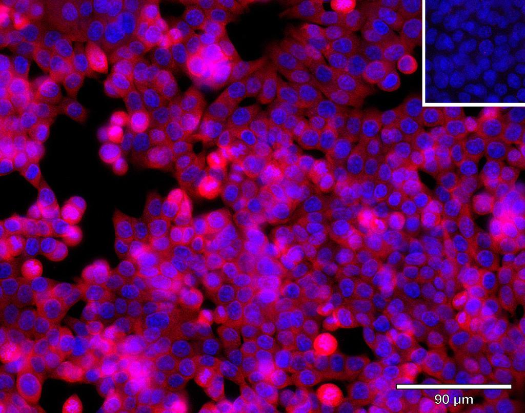 Ankyron FGFR4_HUMAN Clone BJ40481