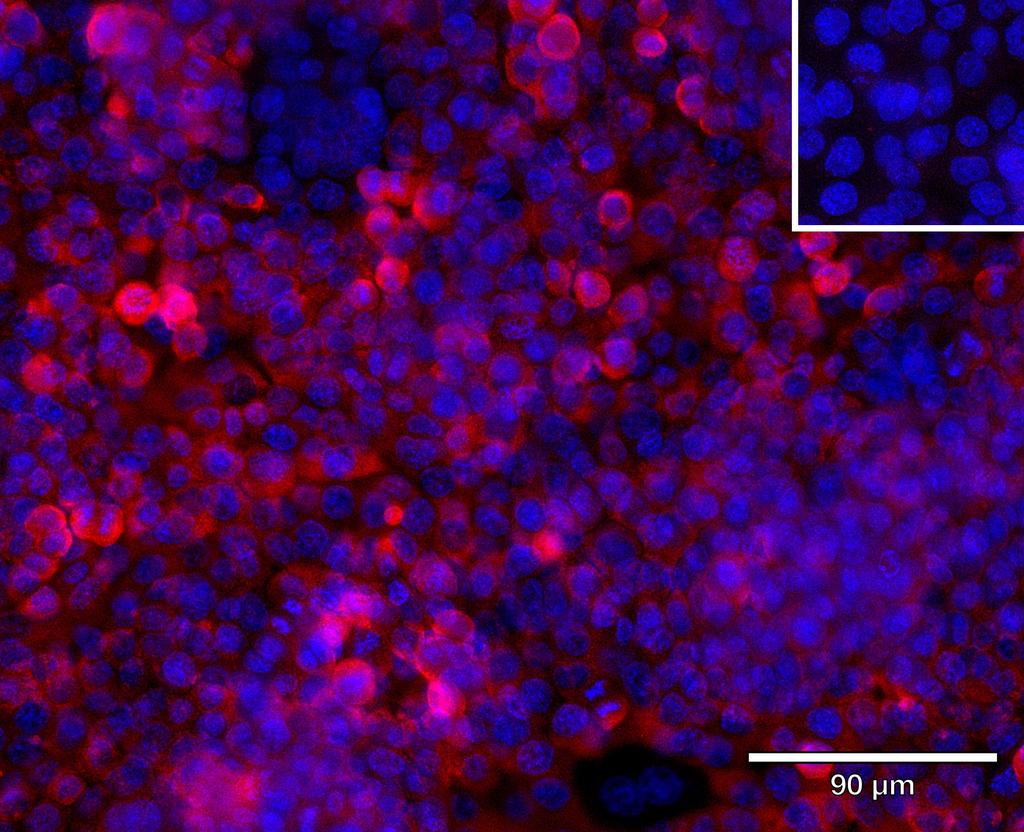 Ankyron FGFR4_HUMAN Clone BJ40483
