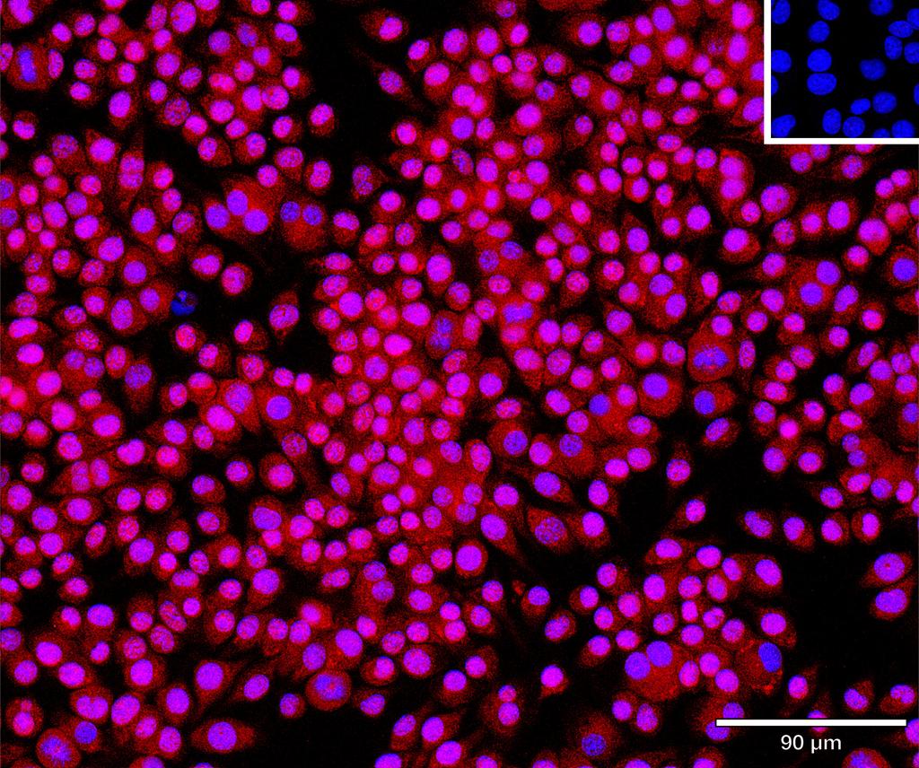 Ankyron FINC_MOUSE Clone BP40127
