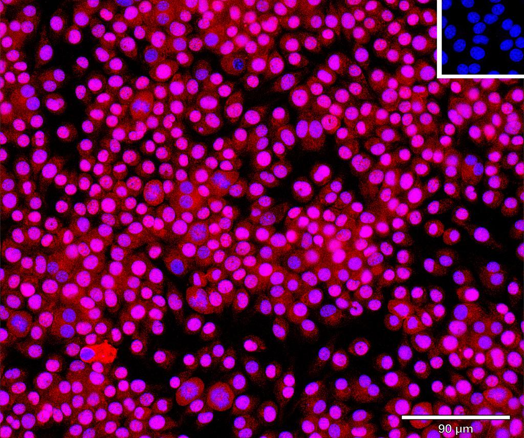 Ankyron FINC_MOUSE Clone BP40132