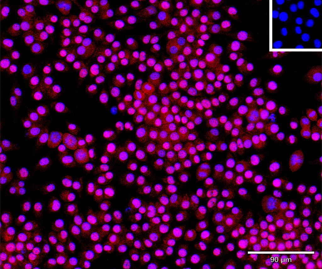 Ankyron FINC_MOUSE Clone BP40142