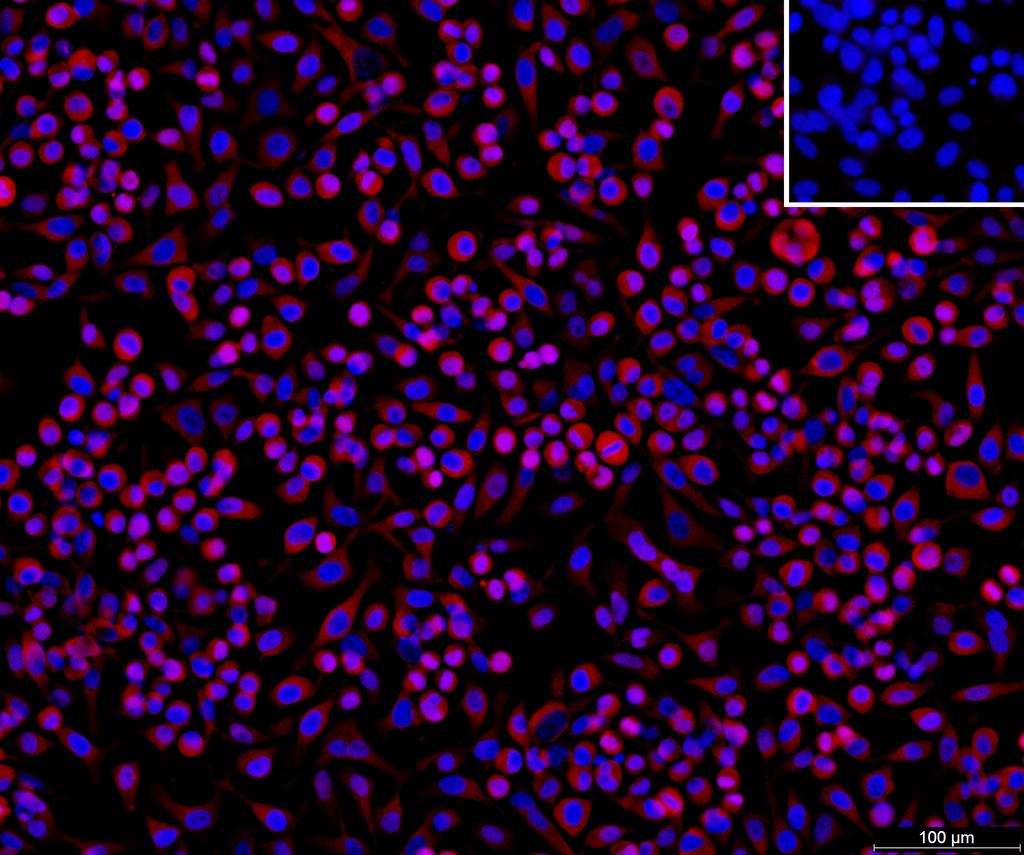 Ankyron FKBP3_HUMAN Clone DB40602