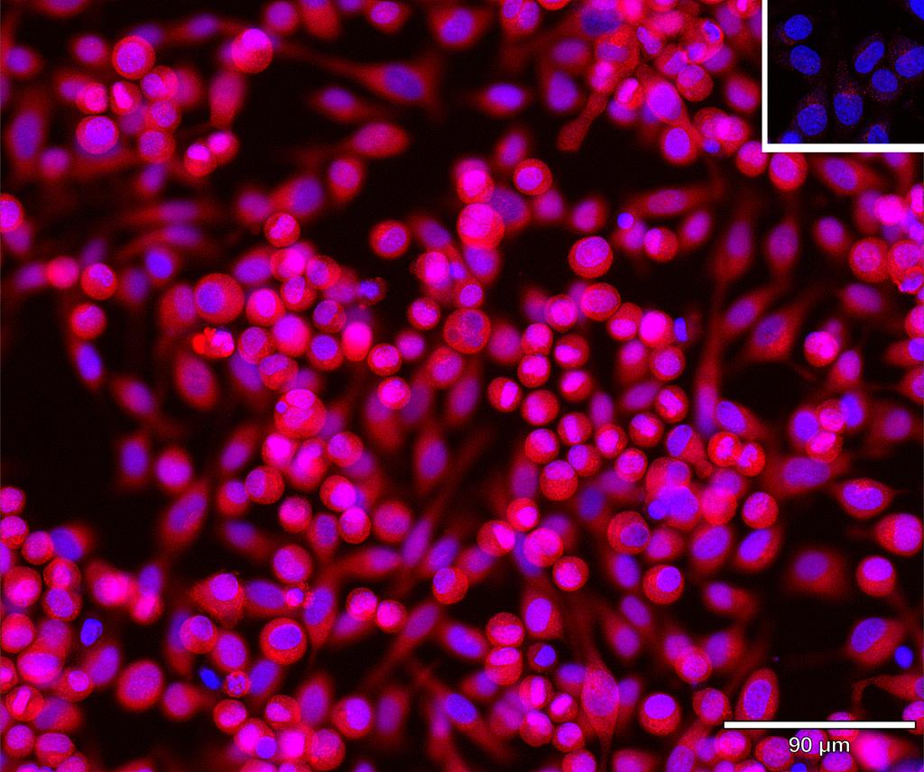 Ankyron FKBP7_HUMAN Clone AR40645