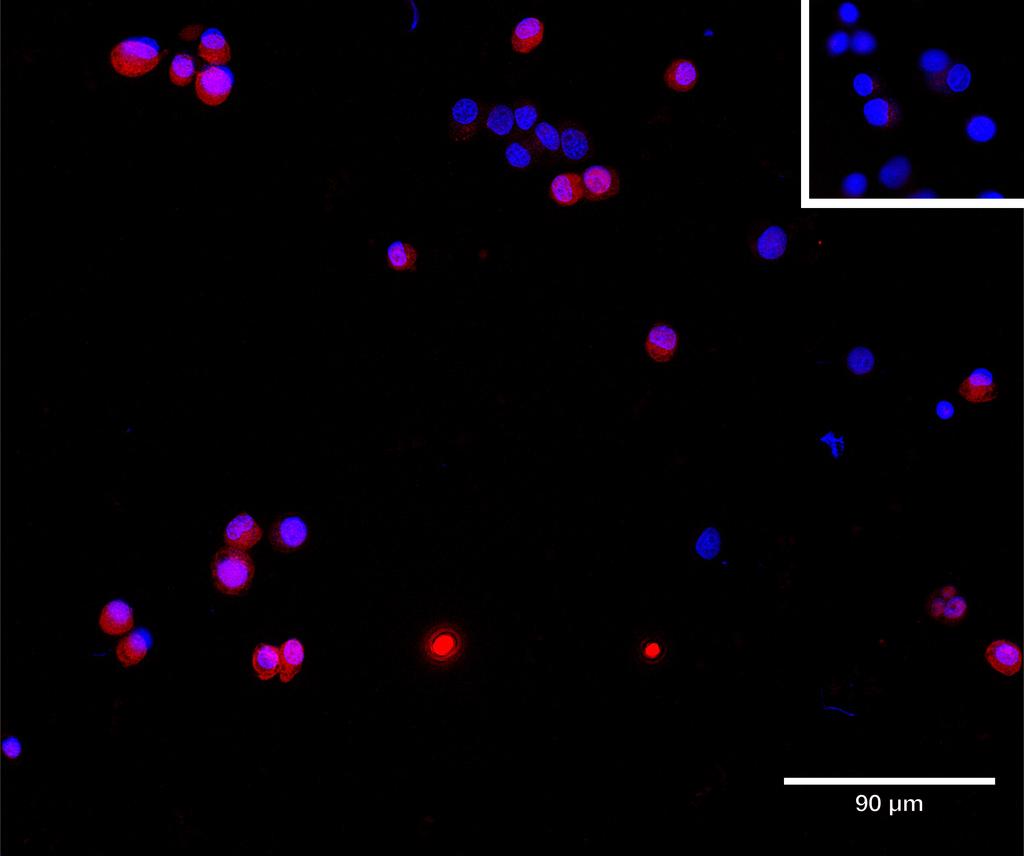 Ankyron FLRT3_HUMAN Clone AH40141