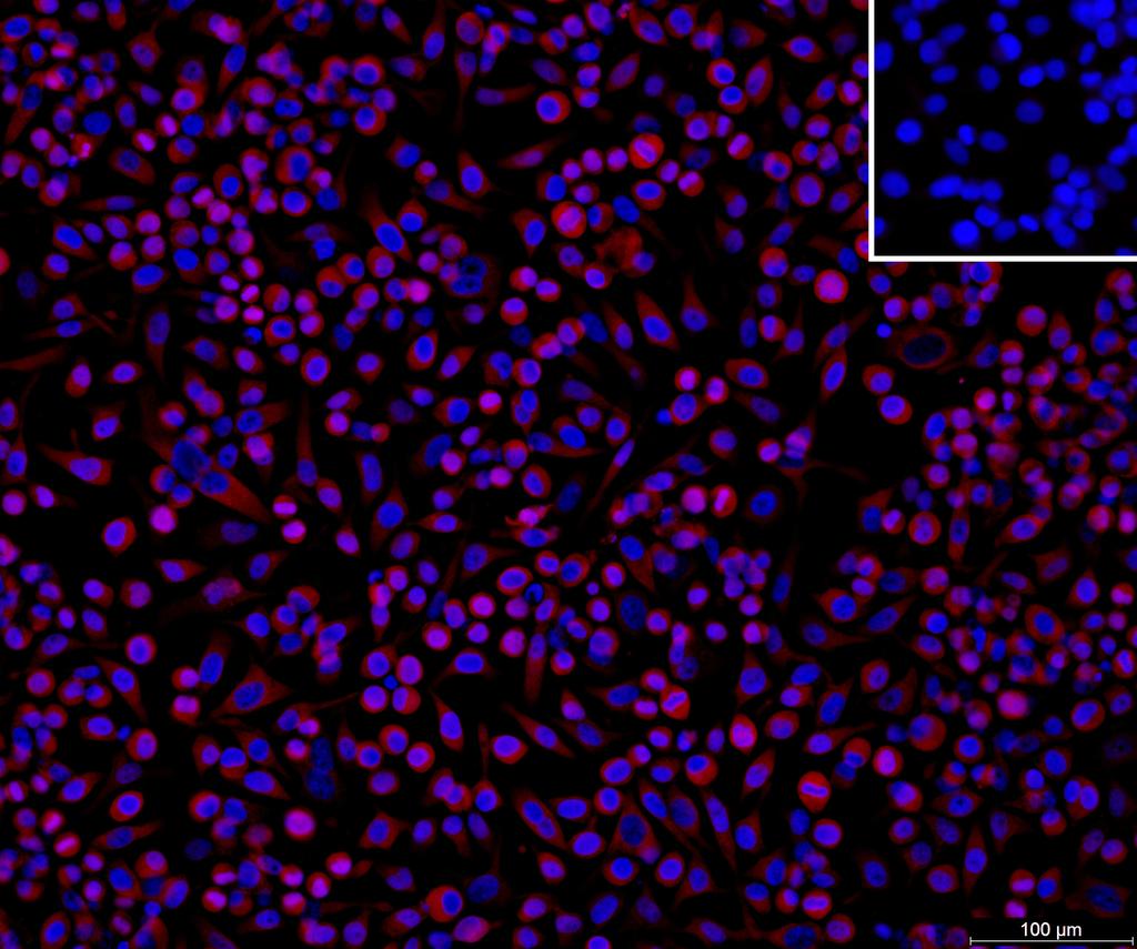 Ankyron FPPS_HUMAN Clone DB40520
