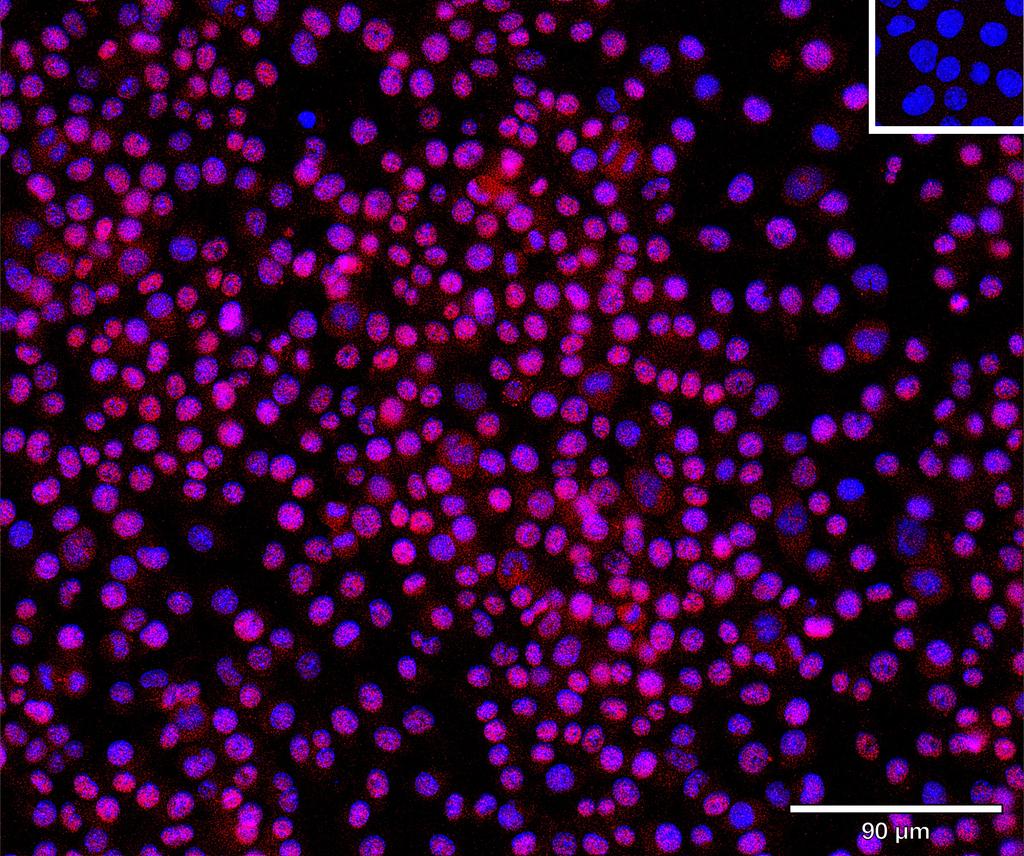Ankyron FUT4_MOUSE Clone CQ40390