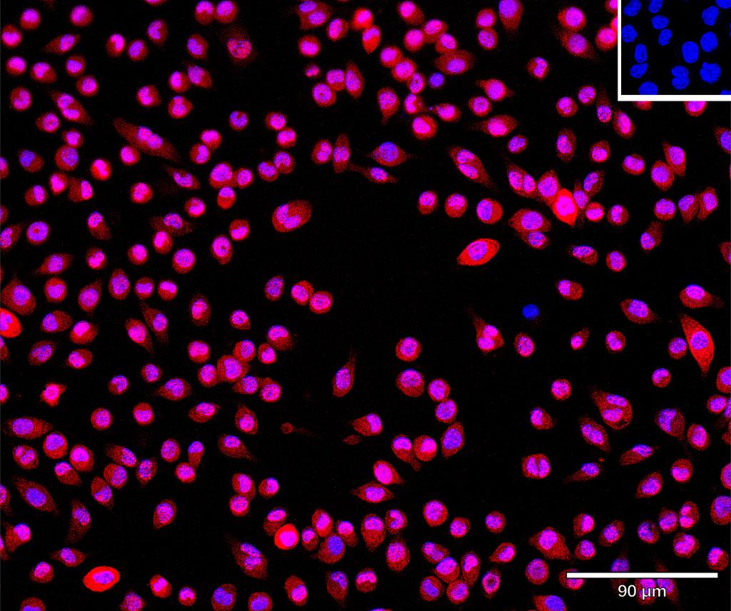 Ankyron FUT4_MOUSE Clone CQ40385