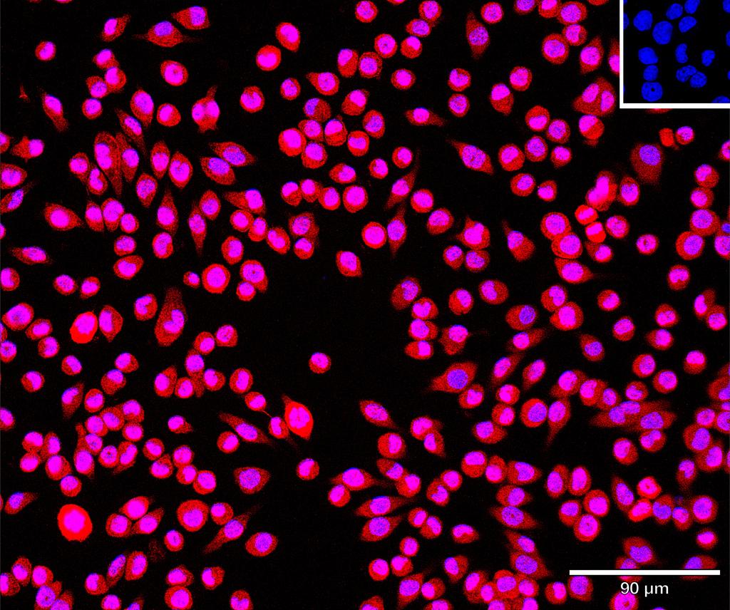 Ankyron FUT4_MOUSE Clone CQ40389
