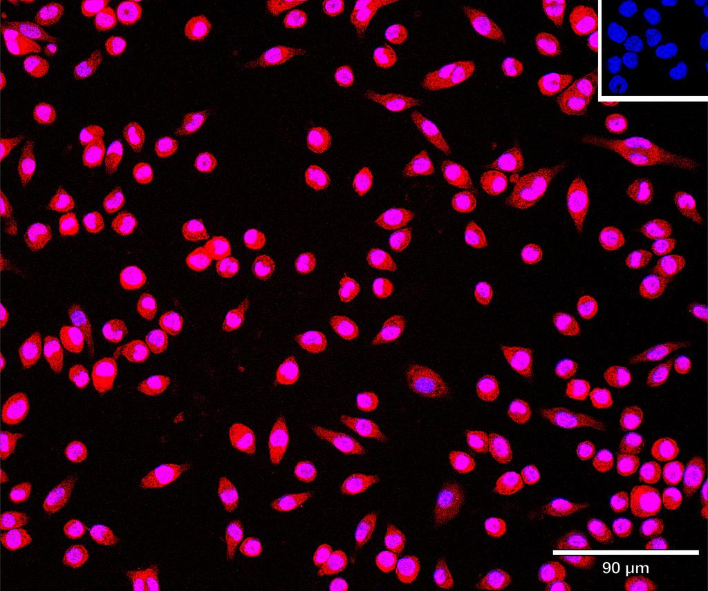 Ankyron FUT4_MOUSE Clone CQ40382