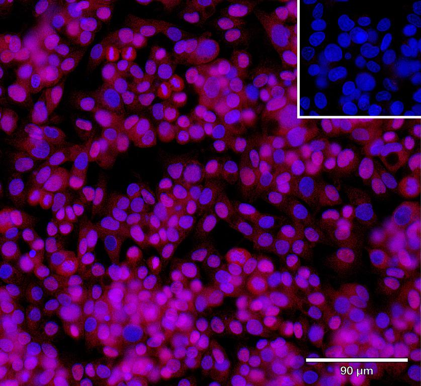 Ankyron FZD6_HUMAN Clone DB40112