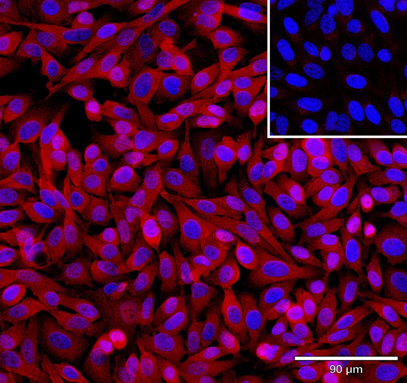 Ankyron GA45G_HUMAN Clone DB40469