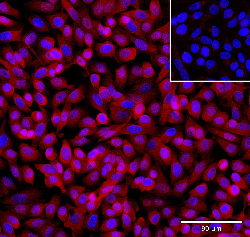 Ankyron GA45G_HUMAN Clone DB40470