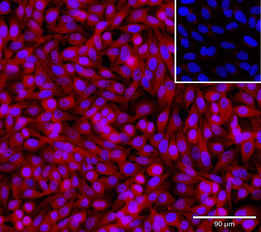 Ankyron GA45G_HUMAN Clone AH40145