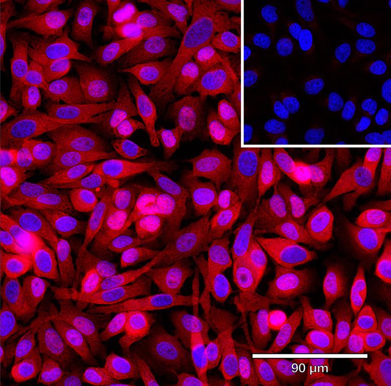 Ankyron GA45G_HUMAN Clone DB40462