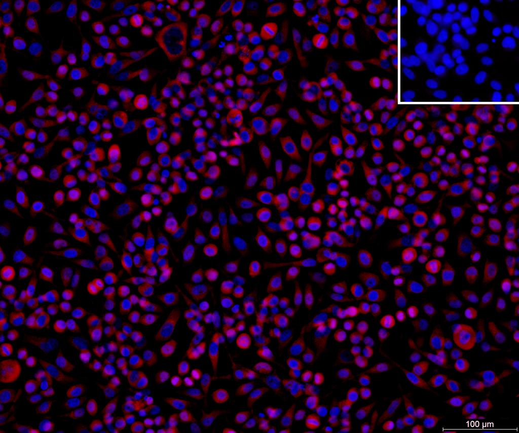 Ankyron GBG1_HUMAN Clone DB40574