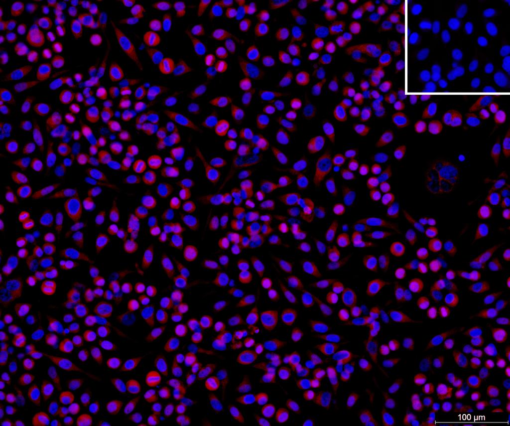 Ankyron GBG1_HUMAN Clone DB40575