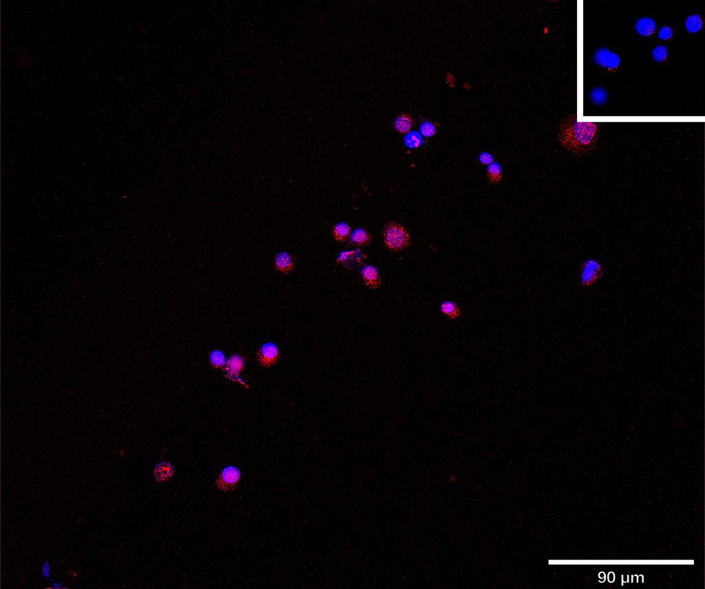 Ankyron GBRB2_HUMAN Clone CG30414
