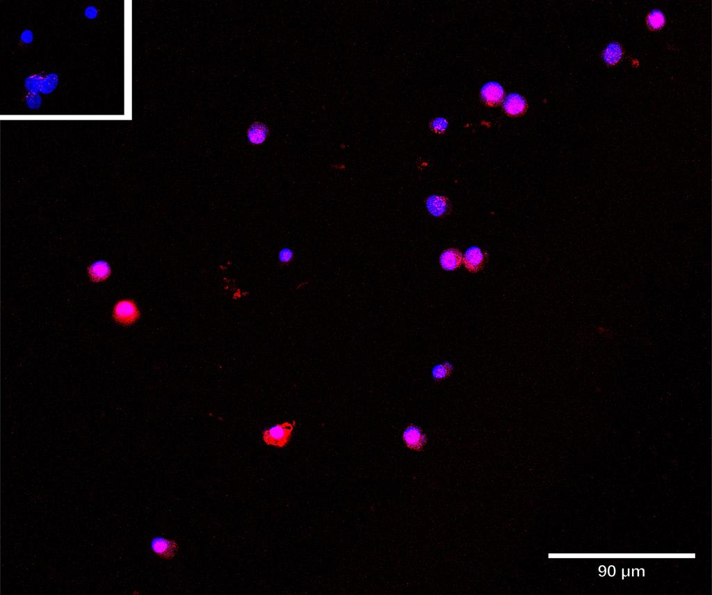 Ankyron GBRB2_HUMAN Clone CG30416