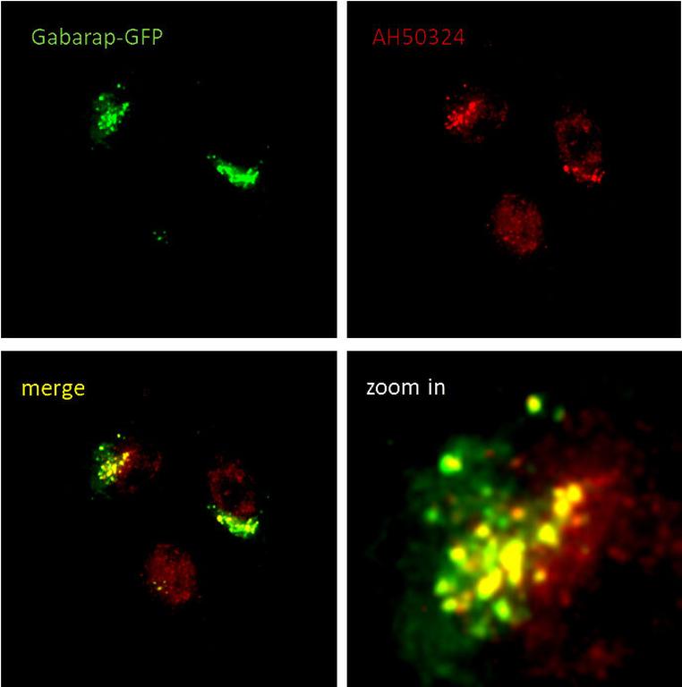 Ankyron GBRL1_HUMAN Clone AH50324