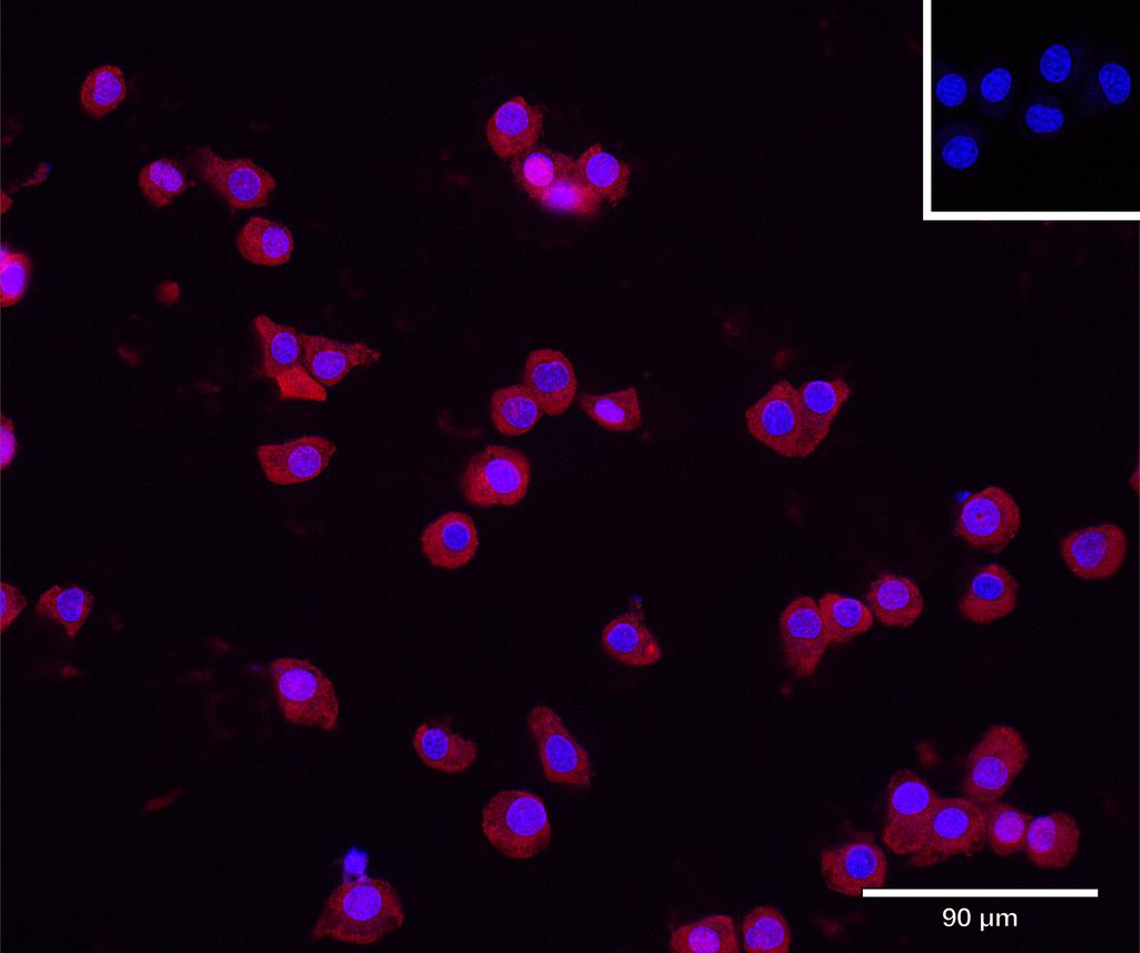 Ankyron GELS_MOUSE Clone DV40643