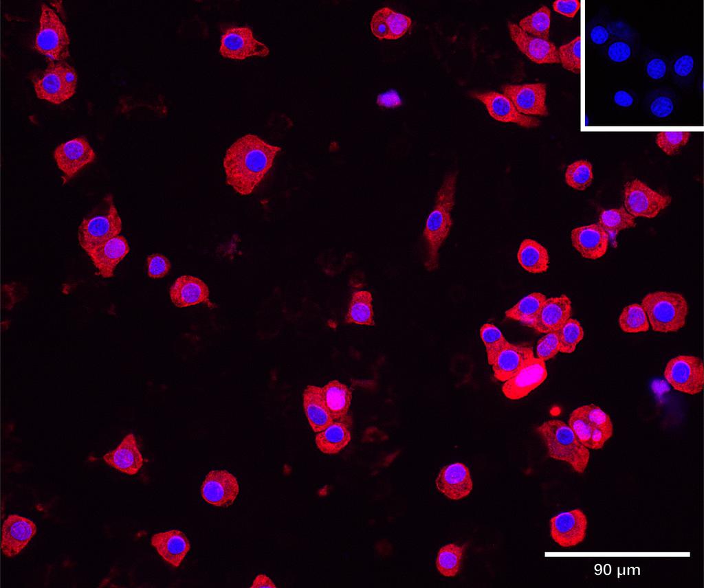 Ankyron GELS_MOUSE Clone DV40644