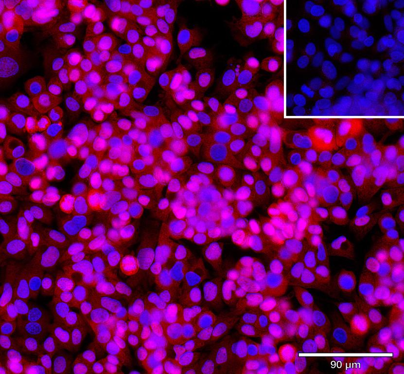 Ankyron GLIP1_HUMAN Clone AH40153