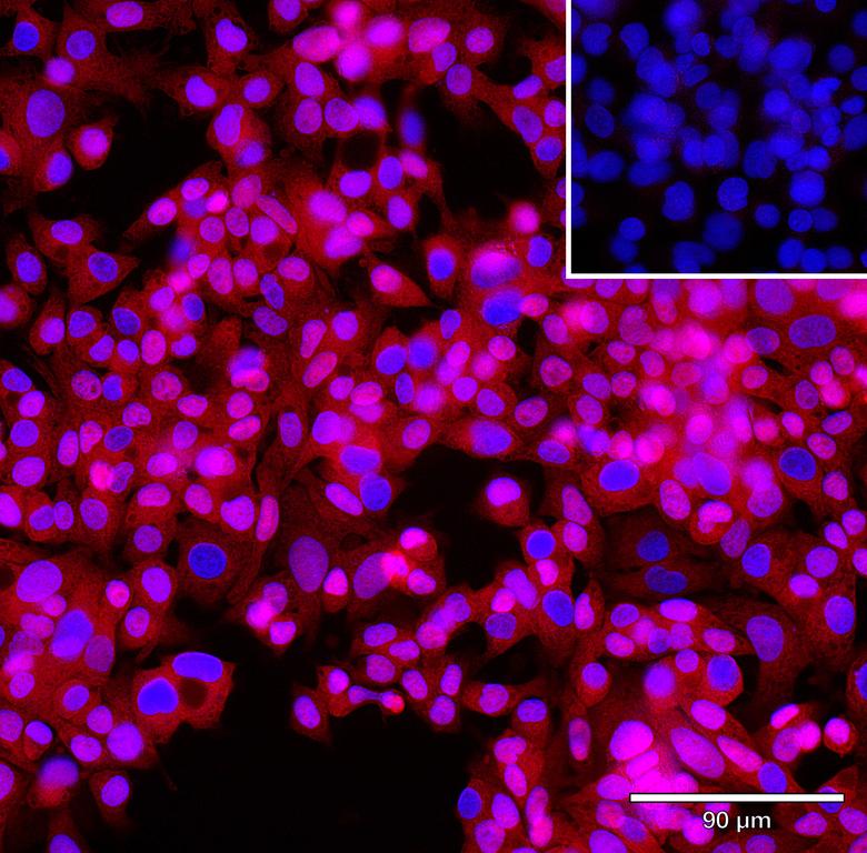 Ankyron GLIP1_HUMAN Clone AH40154