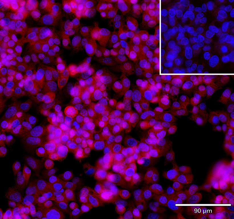 Ankyron GLIP1_HUMAN Clone AH50285