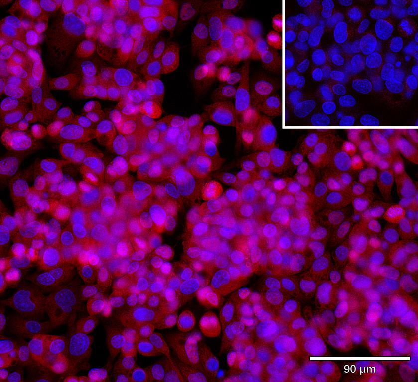 Ankyron GLIP1_HUMAN Clone AH50289