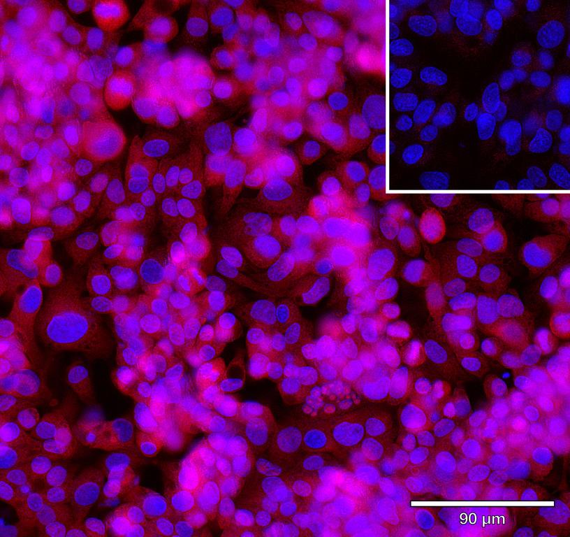 Ankyron GLIP1_HUMAN Clone AH50290