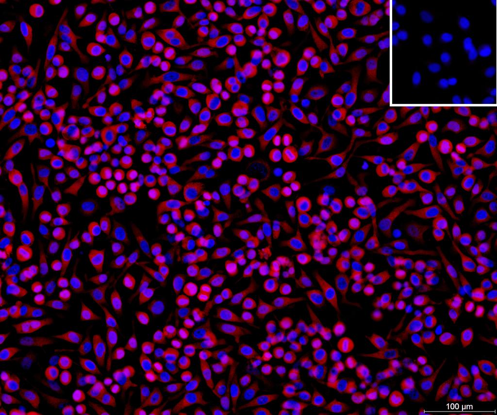 Ankyron GLT10_HUMAN Clone DB40744