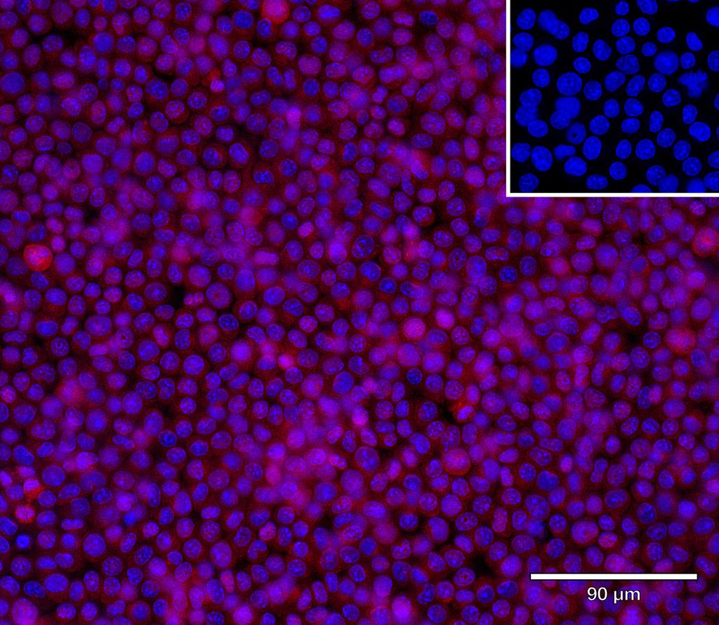 Ankyron GRN_MOUSE Clone DB40536
