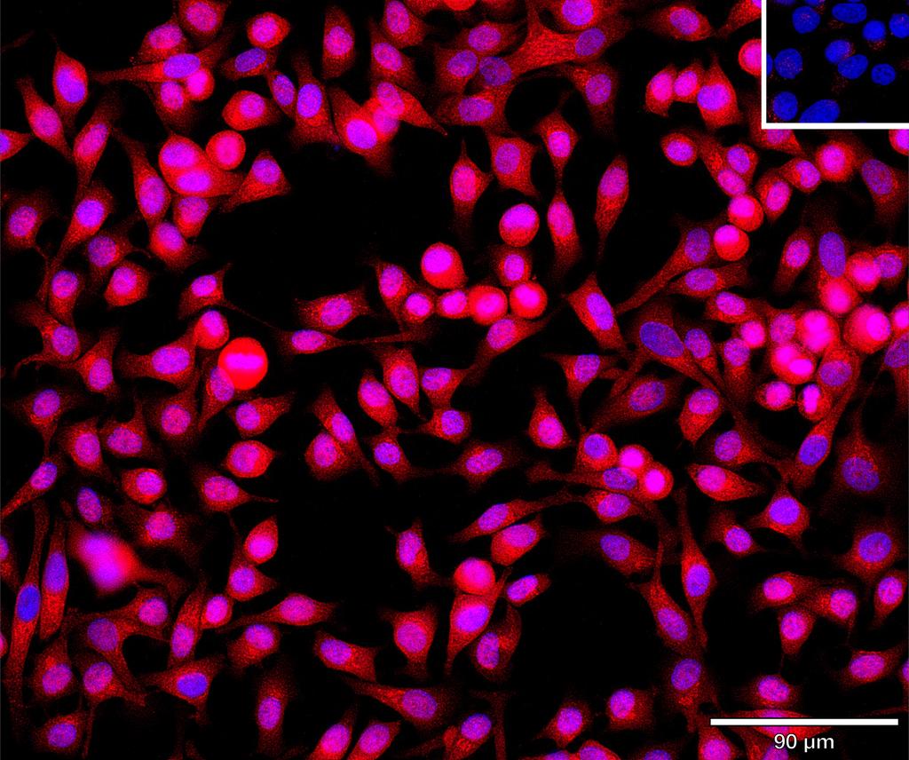 Ankyron GSTP1_HUMAN Clone BZ30920