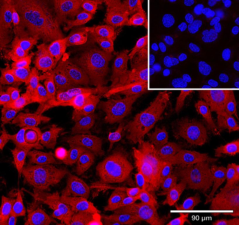 Ankyron HDBP1_HUMAN Clone CS30248