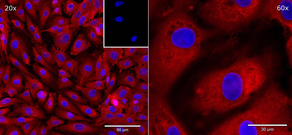 Ankyron HDBP1_HUMAN Clone DB40260