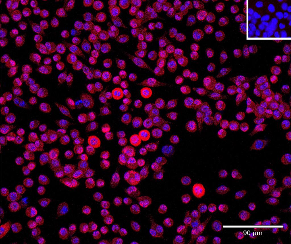 Ankyron HG2A_MOUSE Clone CV40474