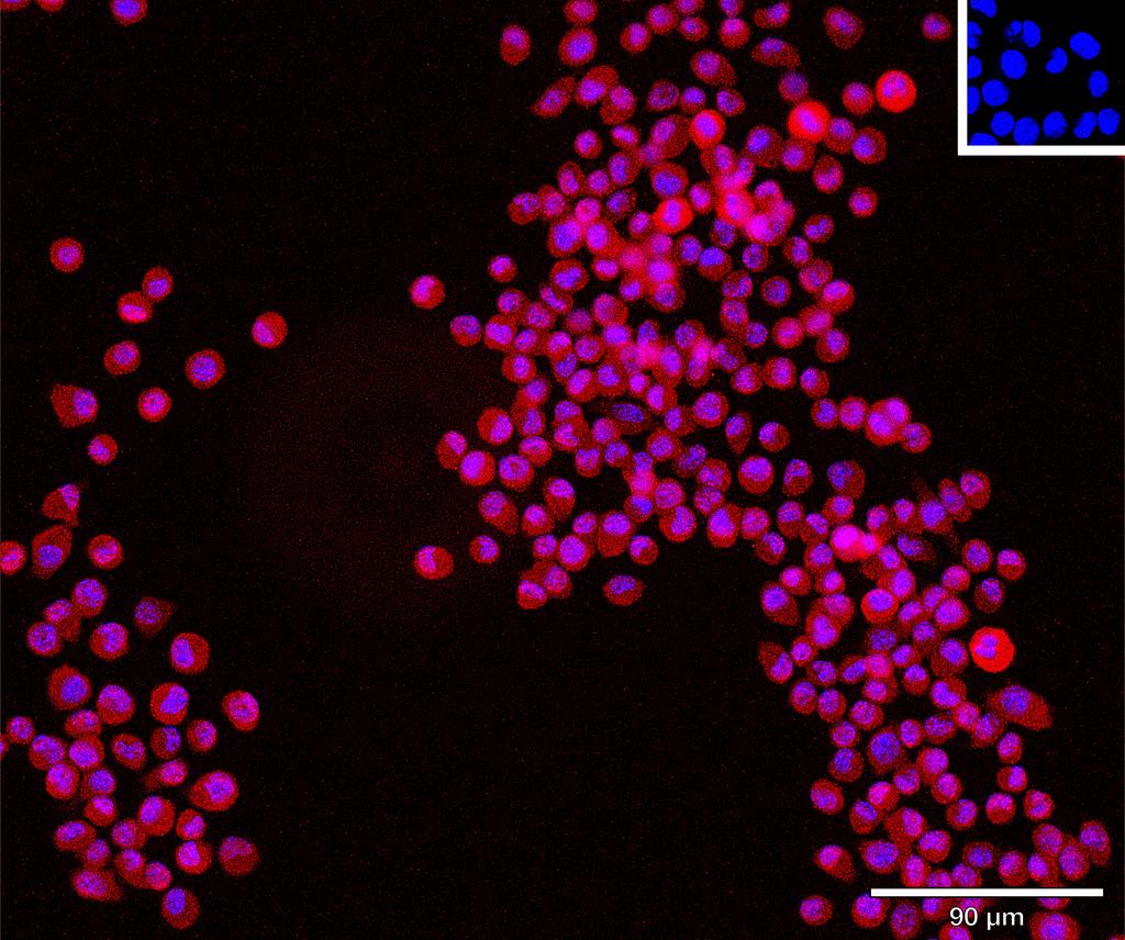 Ankyron HG2A_MOUSE Clone CV40476