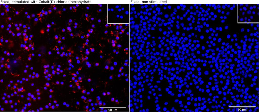 Ankyron HIF1A_MOUSE Clone EM30725