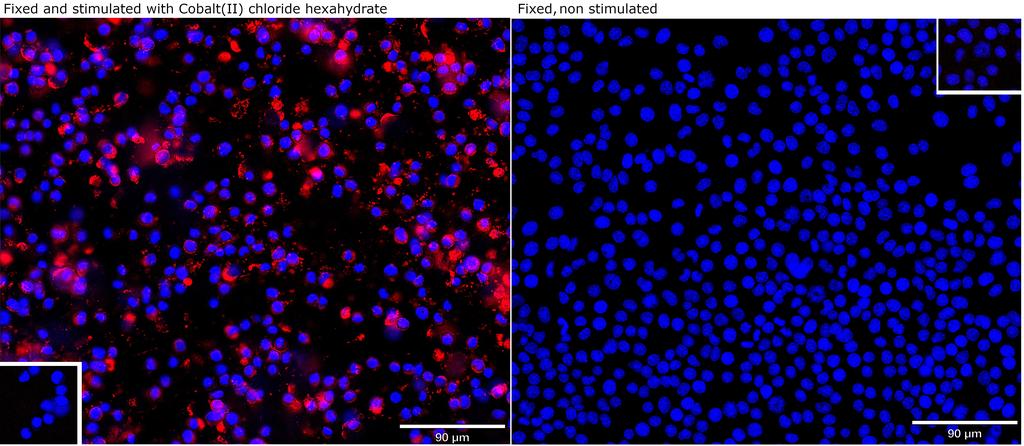 Ankyron HIF1A_MOUSE Clone EM30724