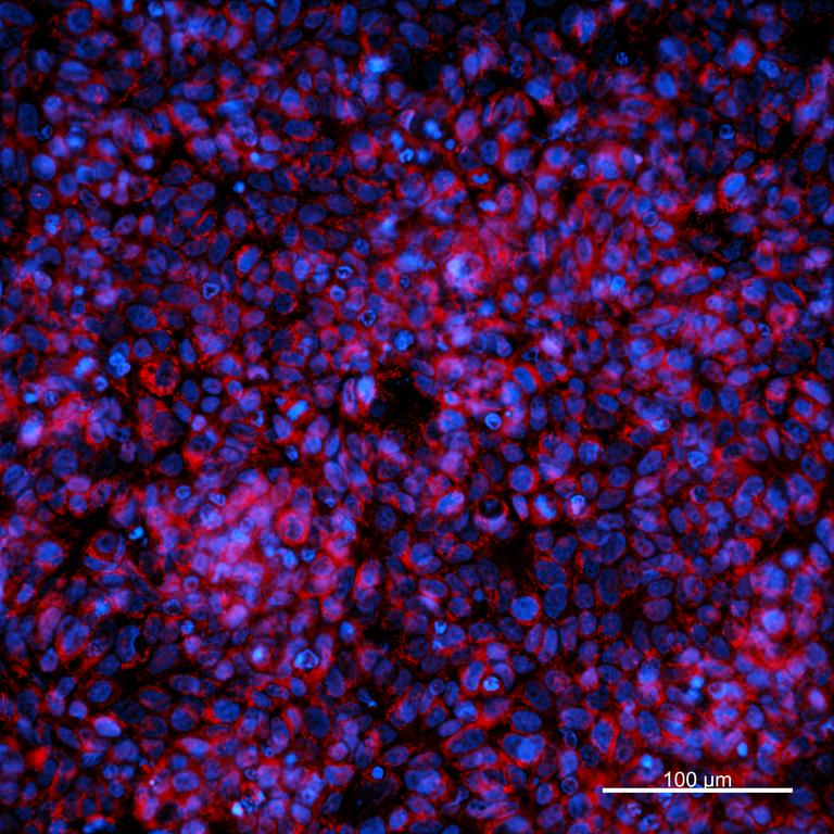 Ankyron I10R2_HUMAN Clone AG40206