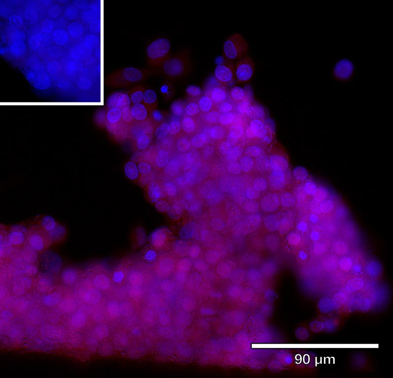 Ankyron I13R2_HUMAN Clone BC40105