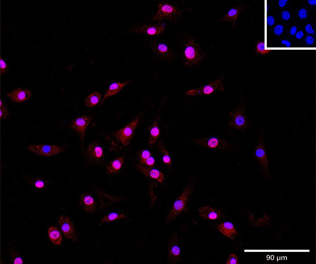 Ankyron I17RD_MOUSE Clone CB30630