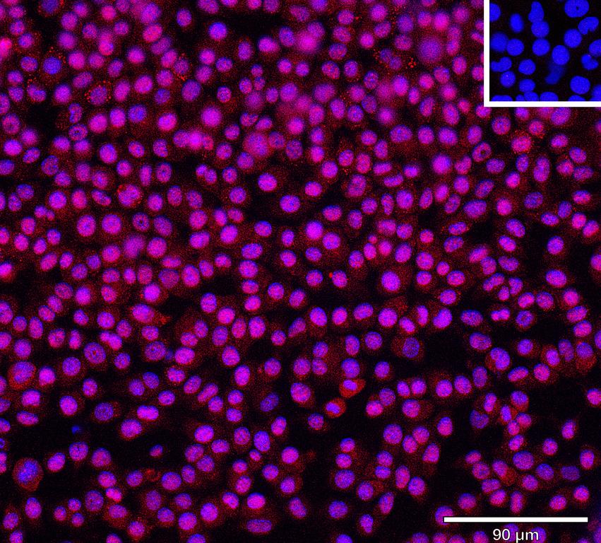 Ankyron I18BP_MOUSE Clone BS40649