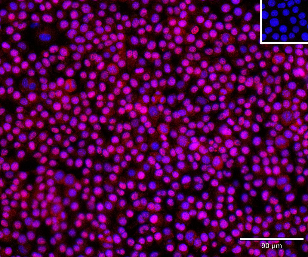 Ankyron I18BP_MOUSE Clone BS40643