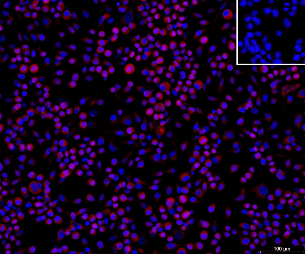 Ankyron I27RA_HUMAN Clone DN40710