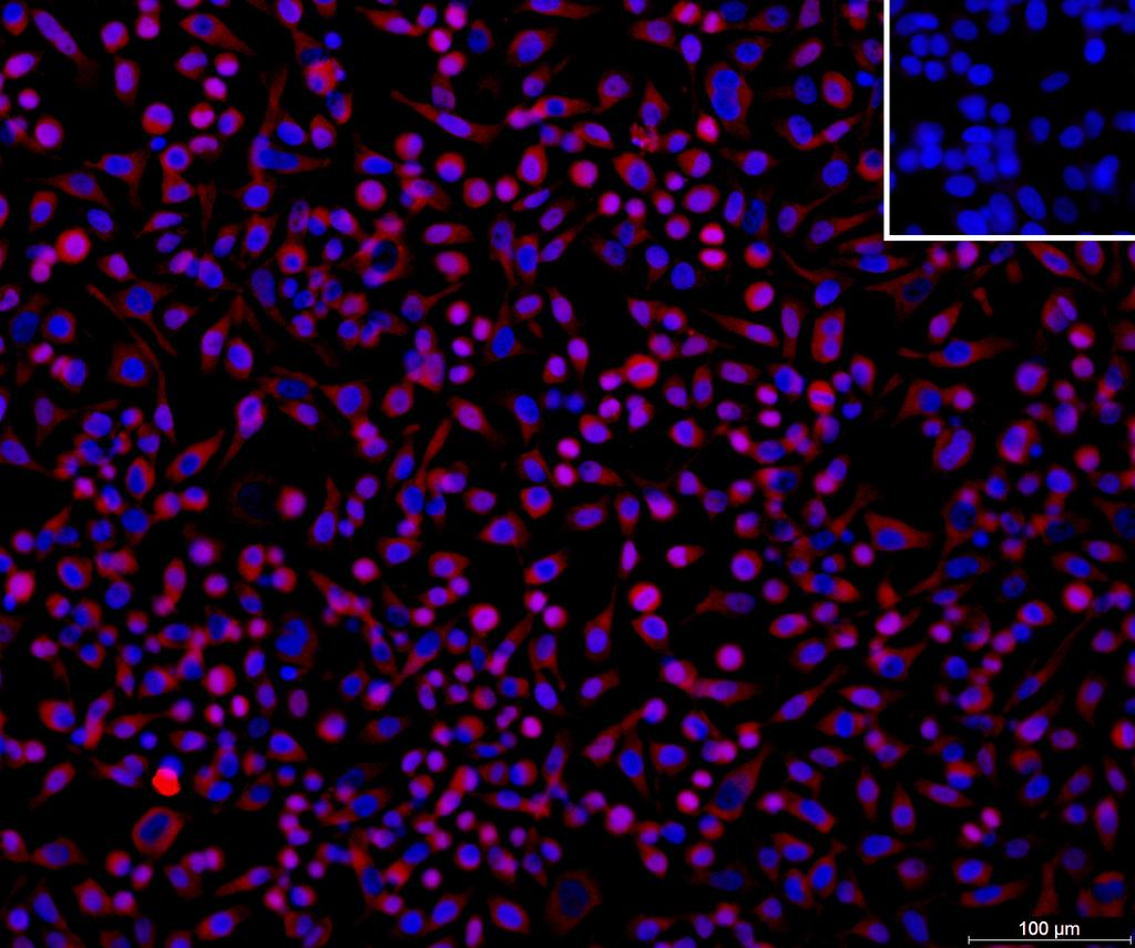 Ankyron I27RA_HUMAN Clone DN40719