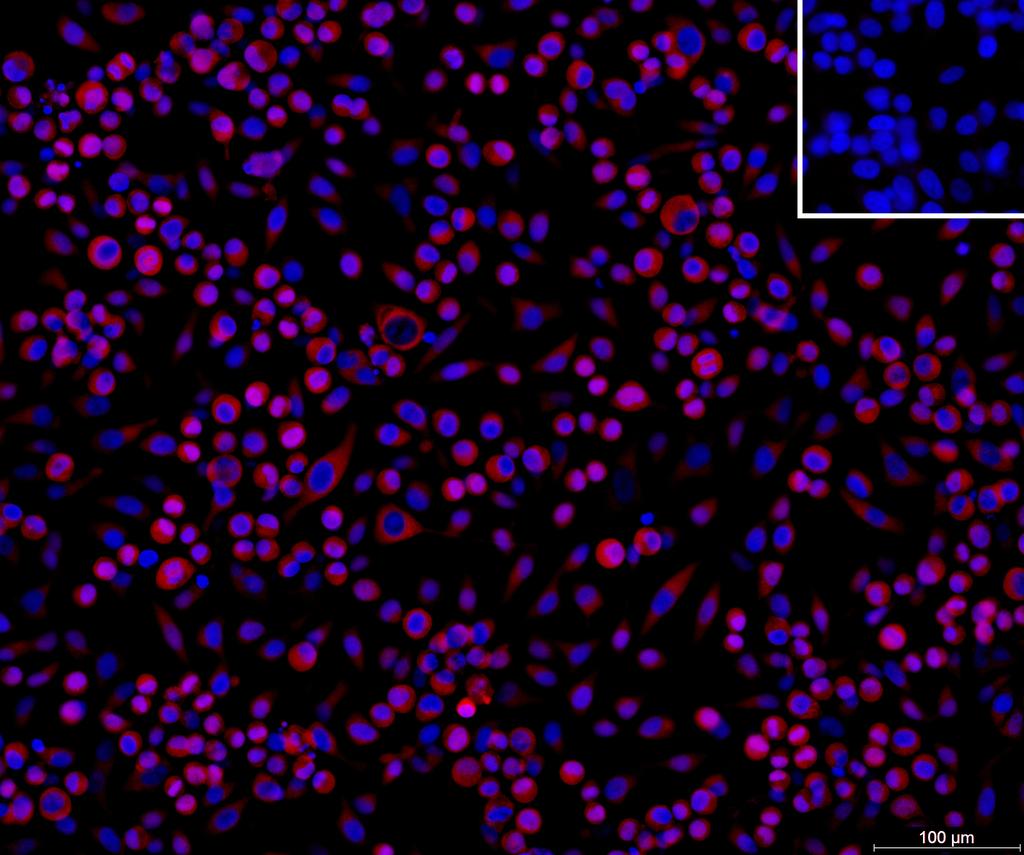 Ankyron I27RA_HUMAN Clone DN40712