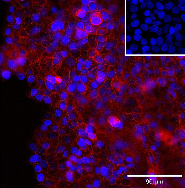 Ankyron I36RA_HUMAN Clone CS30476