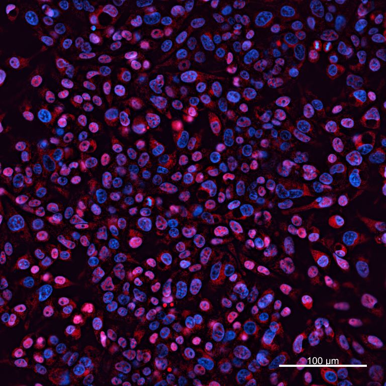Ankyron IBP3_HUMAN Clone BC40433